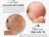 Bí Quyết Cải Thiện Da Khô Mất Nước & Ngăn Ngừa Tăng Sắc Tố – Giải Pháp Từ EM Skin Bar