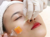 phi kim collagen tươi