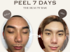 Peel 7 Days 