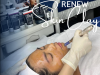 iPEEL Renew Skin Clay K 