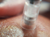 Pro Microneedling Dermalogica