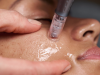 Pro Nanoneedling Dermalogica 