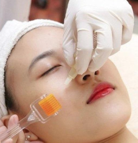 phi kim collagen tươi