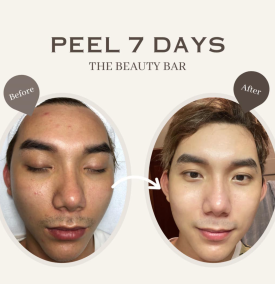 Peel 7 Days 