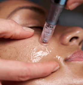 Pro Nanoneedling Dermalogica 