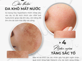 Bí Quyết Cải Thiện Da Khô Mất Nước & Ngăn Ngừa Tăng Sắc Tố – Giải Pháp Từ EM Skin Bar