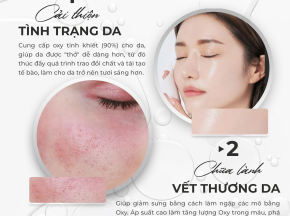 Liệu Pháp Oxy Tinh Khiết 90% – Bí Quyết Cải Thiện Tình Trạng Da & Chữa Lành Vết Thương Hiệu Quả
