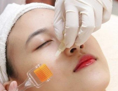 phi kim collagen tươi